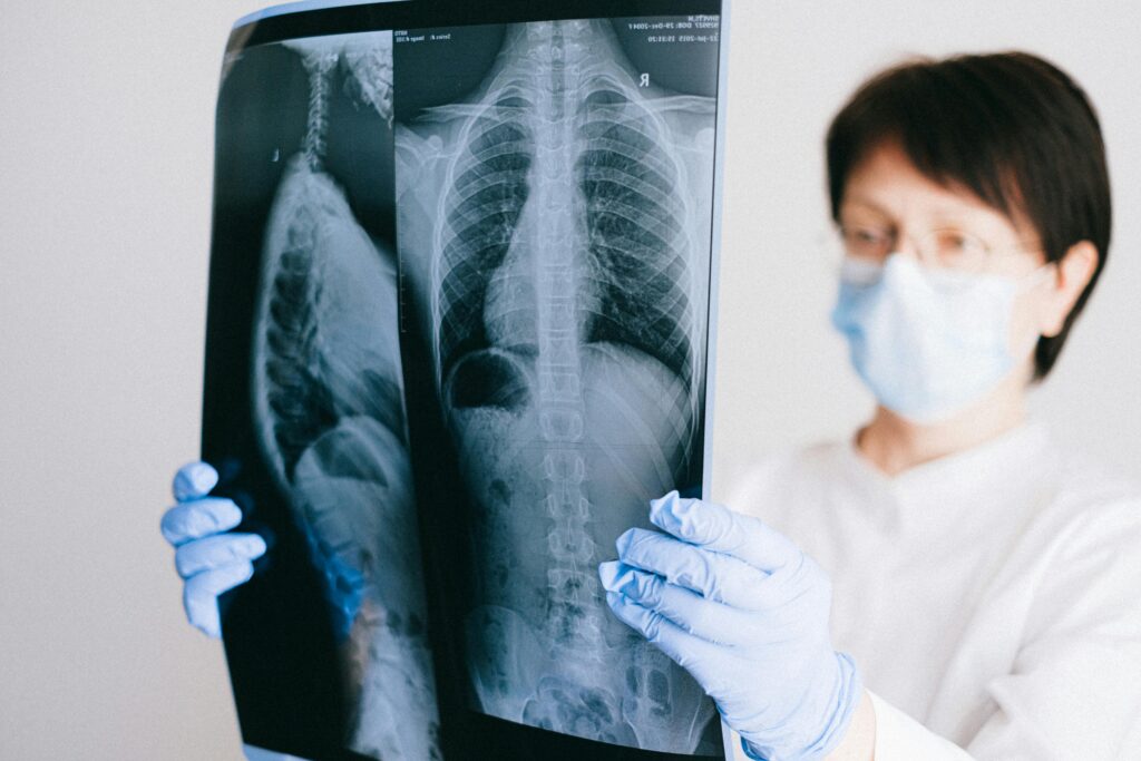 A medical professional analyzes a chest x-ray wearing gloves and a mask in a clinical setting.